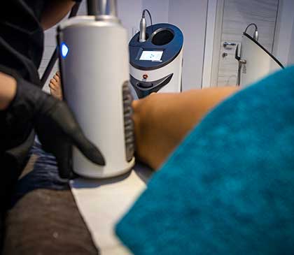 gamba sinistra di un donna che si sta sottoponendo ad un trattamento rassodante