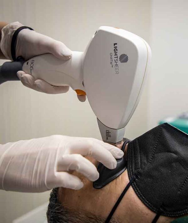 volto di un uomo mentre si sottopone all'epilazione laser a diodo