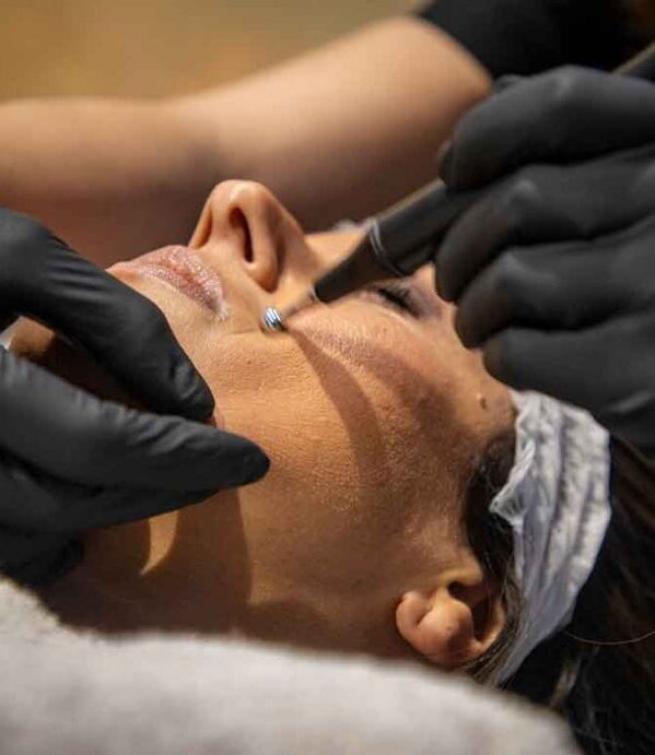 volto di una donna mentre si sottopone ad un trattamento ti microlifting non chirurgico