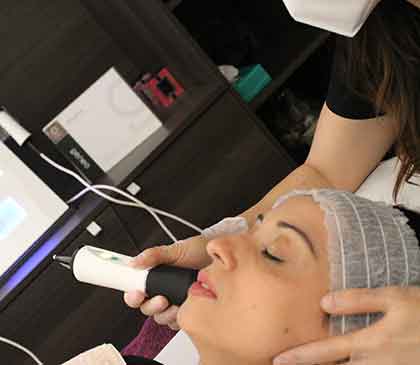 ragazza si sottopone ad un trattamento viso eseguito con il macchinario Geneo